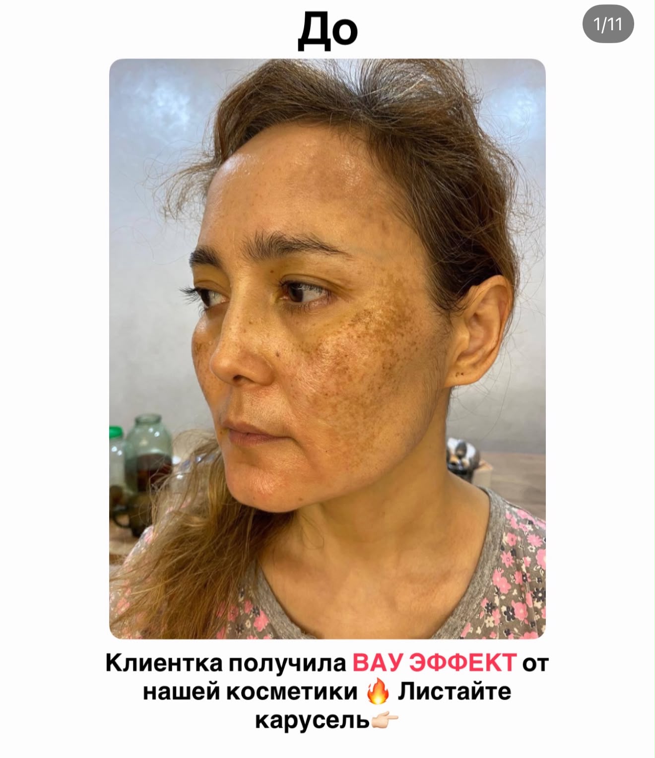 Результат клиентки после ухода KELBET